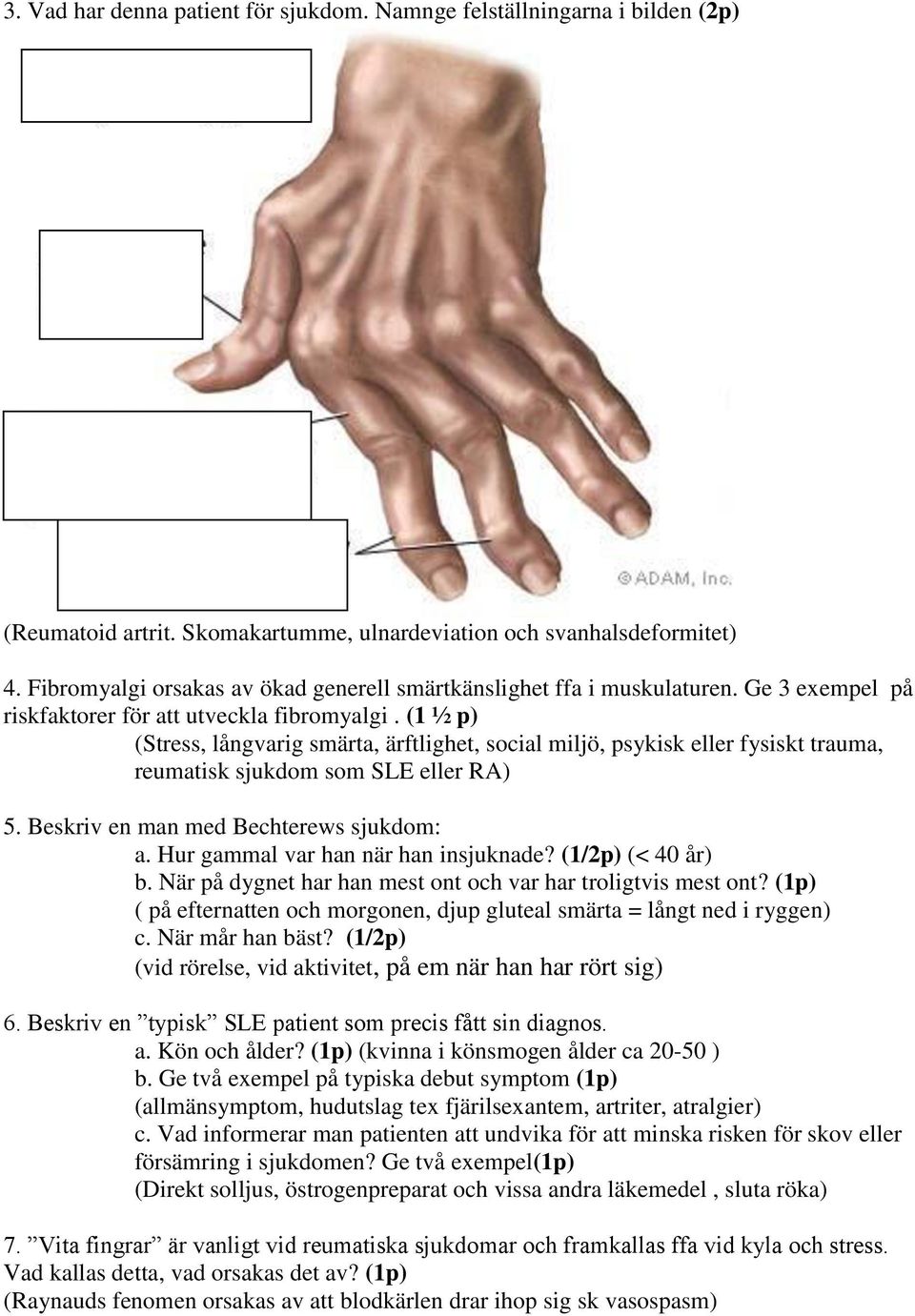 (1 ½ p) (Stress, långvarig smärta, ärftlighet, social miljö, psykisk eller fysiskt trauma, reumatisk sjukdom som SLE eller RA) 5. Beskriv en man med Bechterews sjukdom: a.