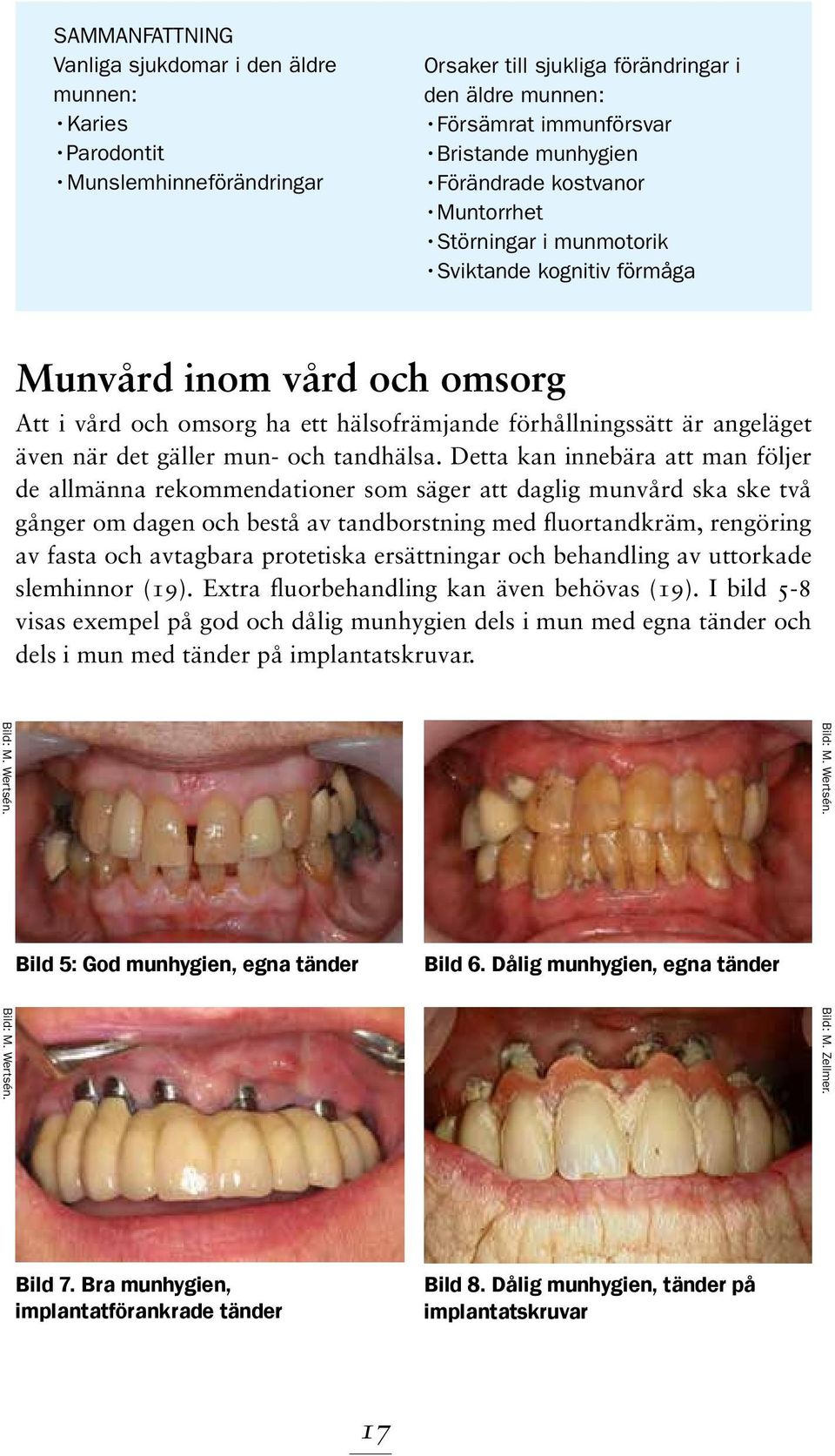 gäller mun- och tandhälsa.