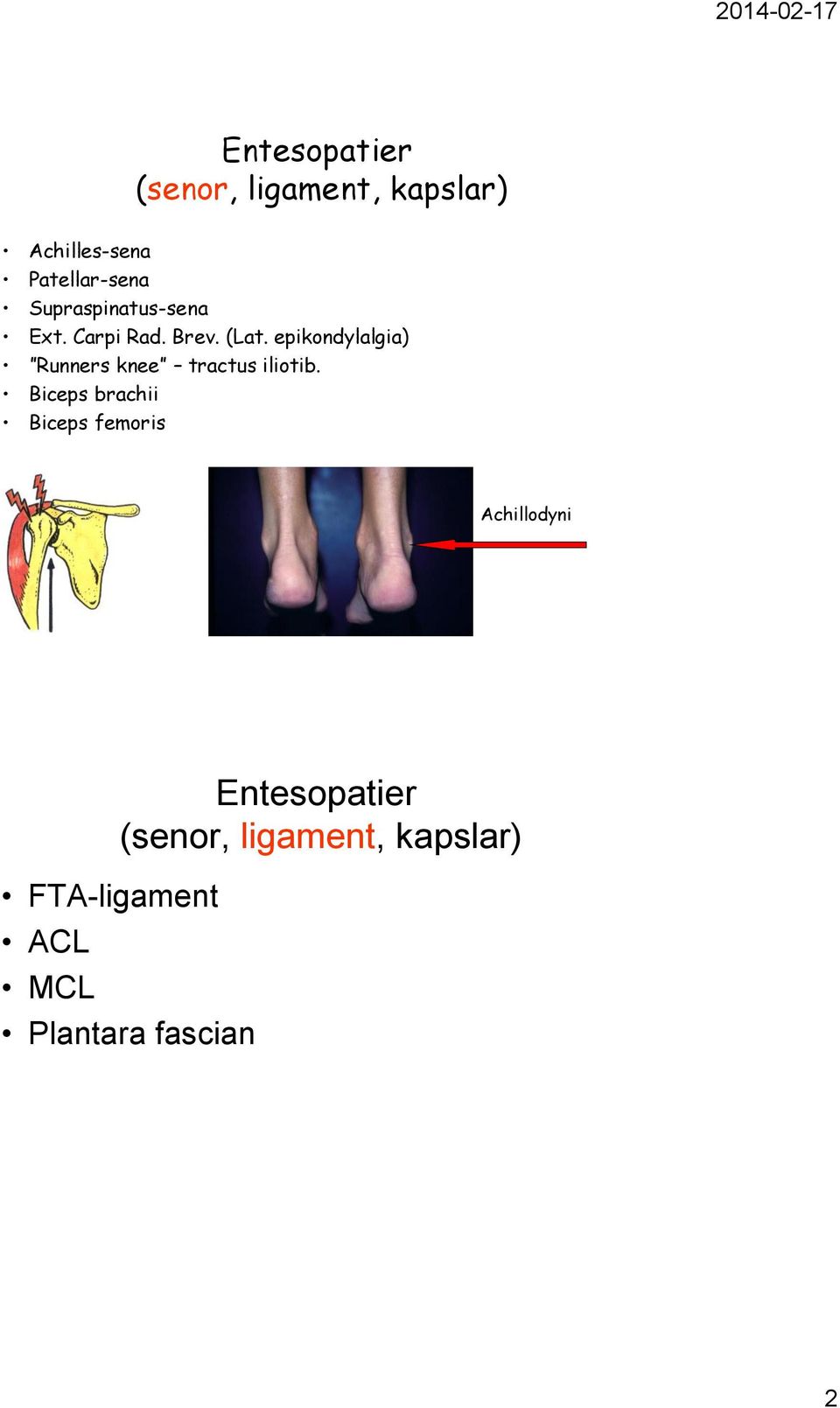 epikondylalgia) Runners knee tractus iliotib.