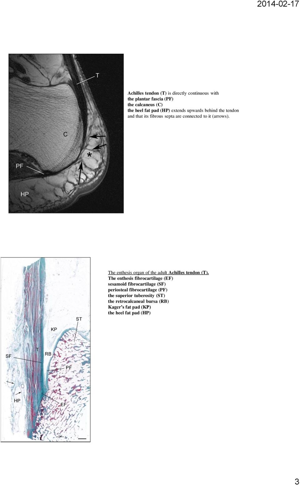 The enthesis organ of the adult Achilles tendon (T).