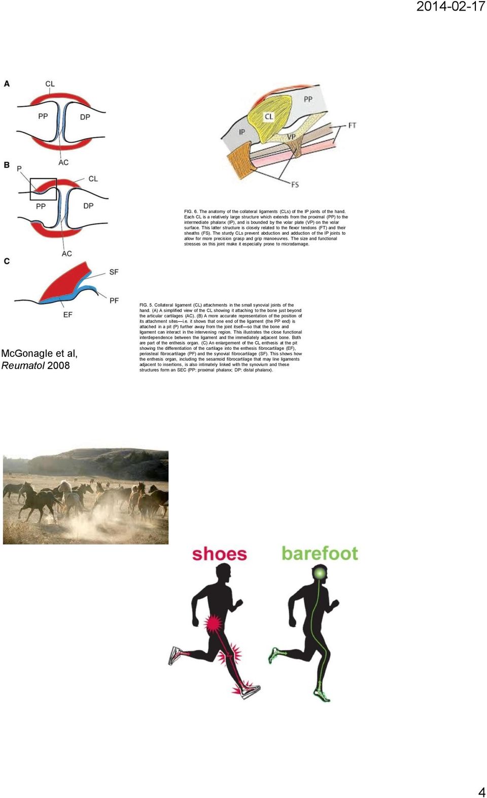 This latter structure is closely related to the flexor tendons (FT) and their sheaths (FS).