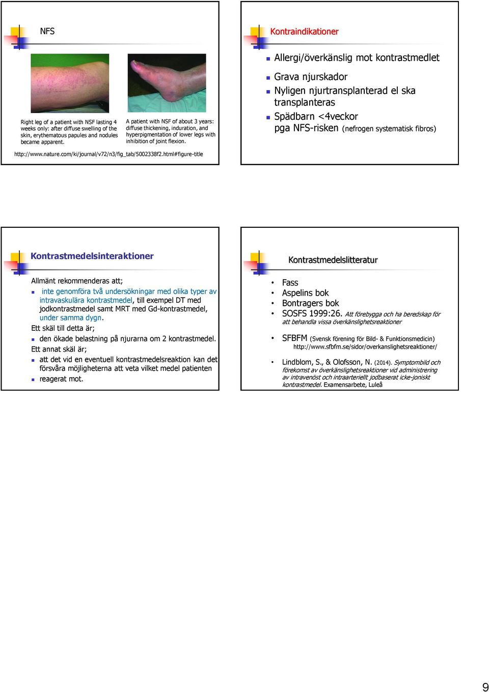 Grava njurskador Nyligen njurtransplanterad el ska transplanteras Spädbarn <4veckor pga NFS-risken (nefrogen systematisk fibros) http://www.nature.com/ki/journal/v72/n3/fig_tab/5002338f2.