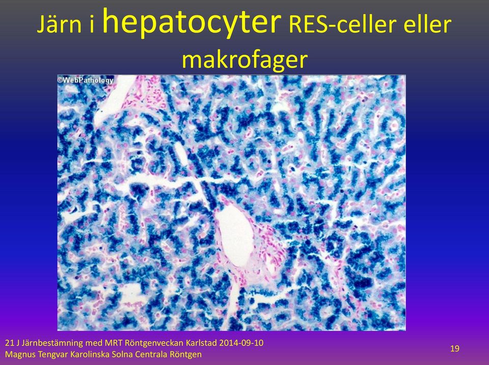 RES-celler