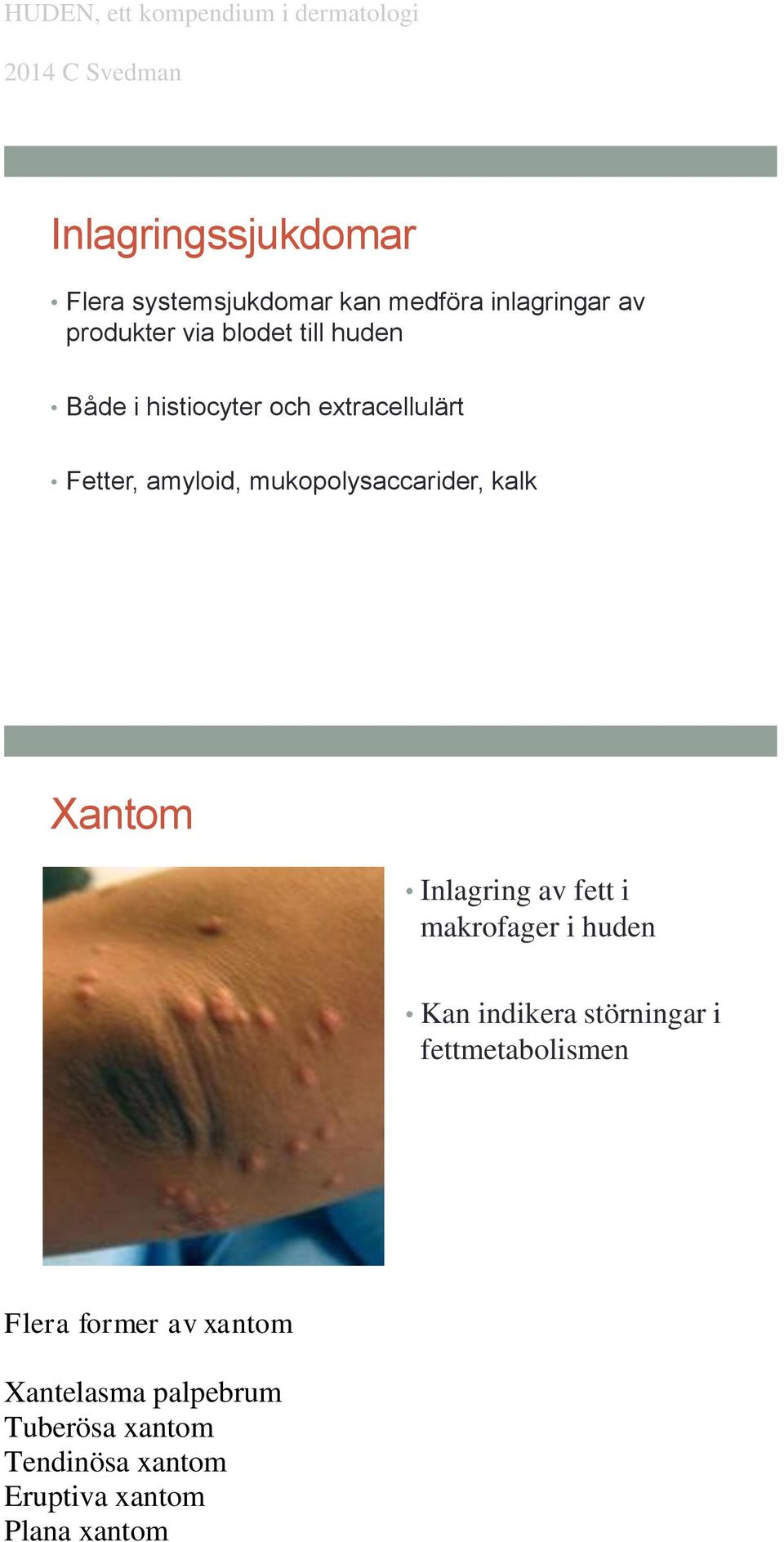 Xantom Inlagring av fett i makrofager i huden Kan indikera störningar i fettmetabolismen