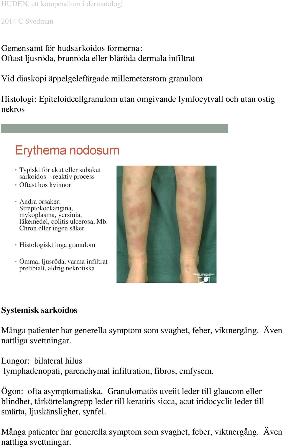 colitis ulcerosa, Mb.