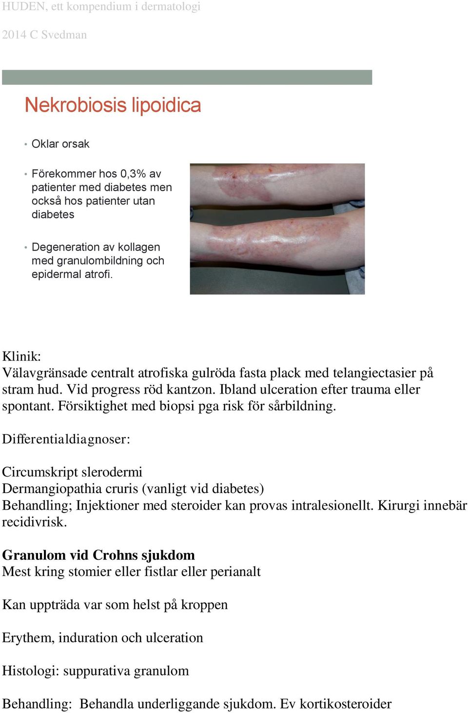 Försiktighet med biopsi pga risk för sårbildning.