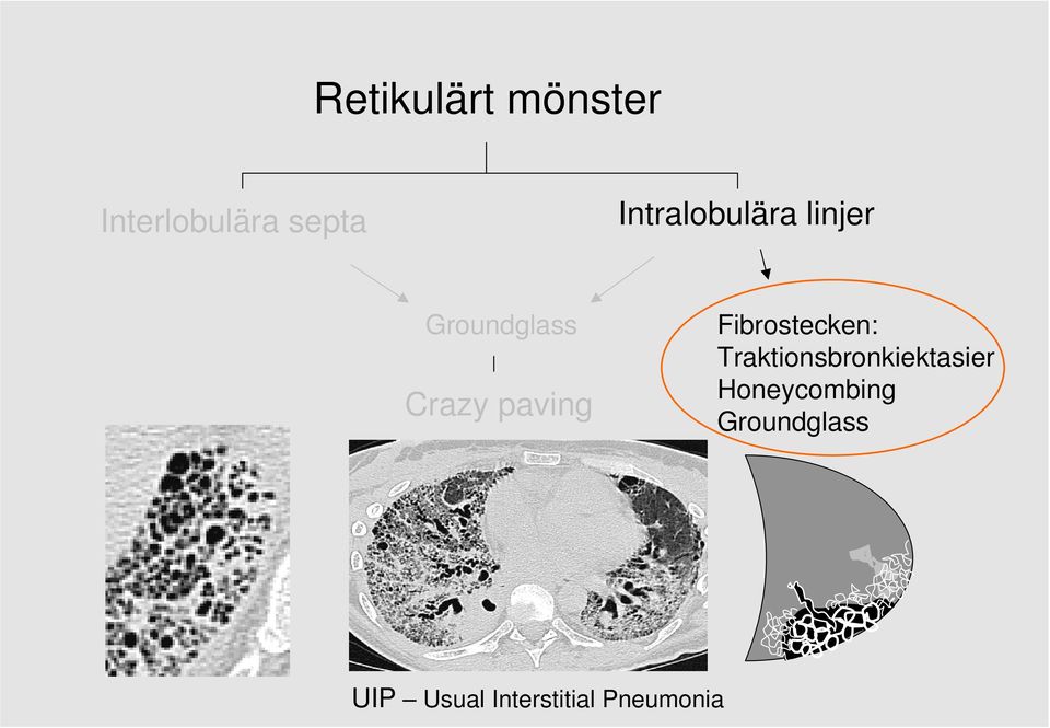 paving Fibrostecken: