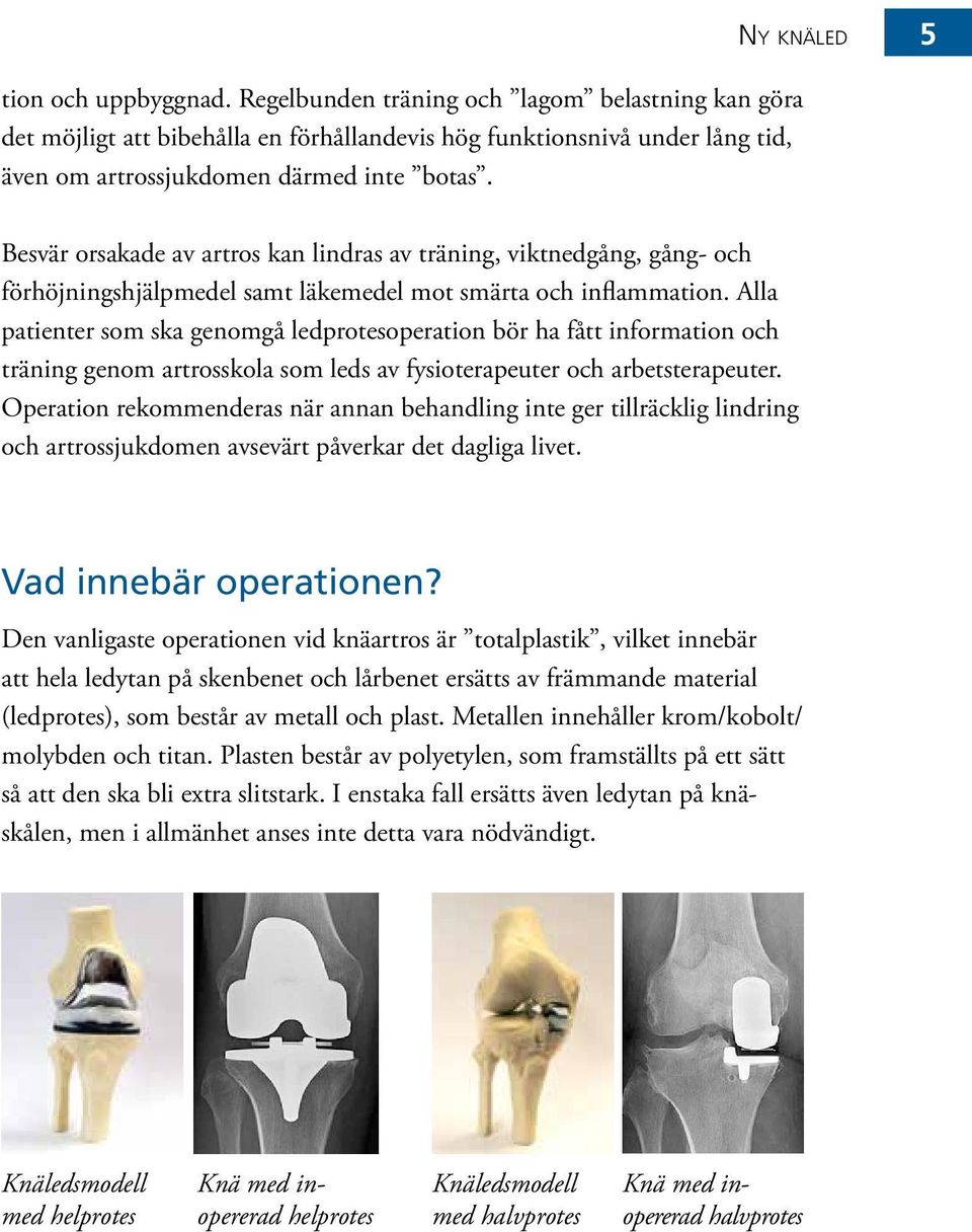 Besvär orsakade av artros kan lindras av träning, viktnedgång, gång- och förhöjningshjälpmedel samt läkemedel mot smärta och inflammation.