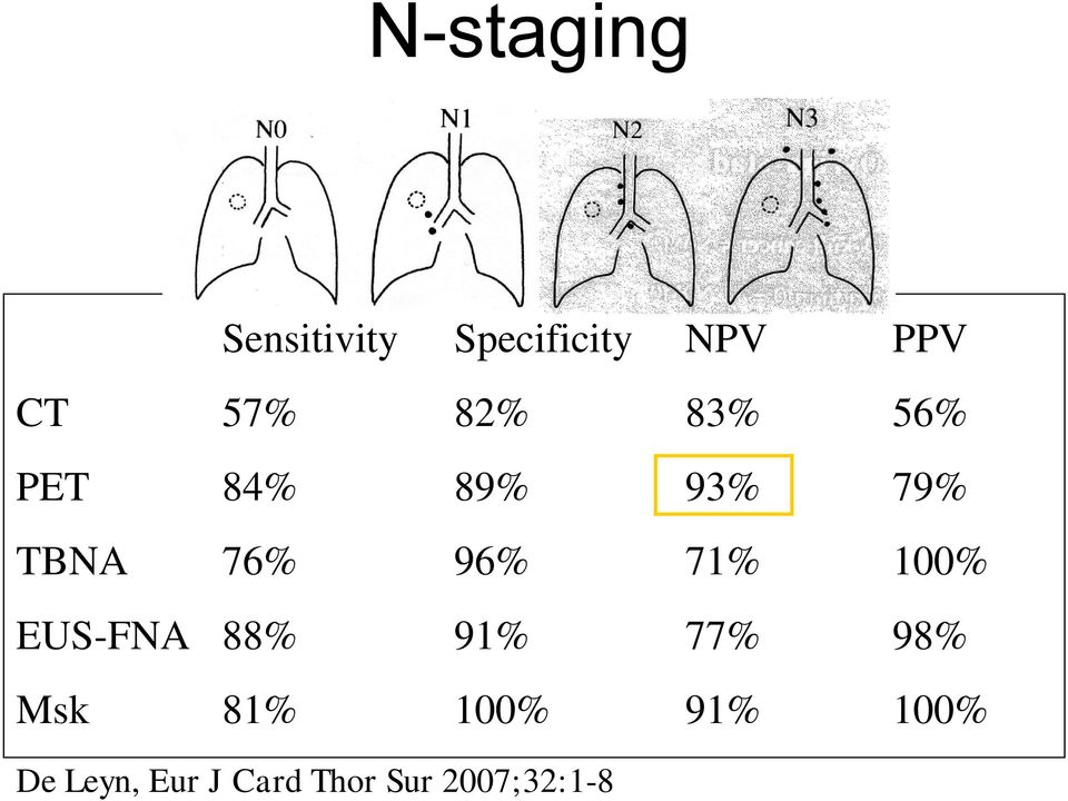 96% 71% 100% EUS-FNA 88% 91% 77% 98% Msk 81%