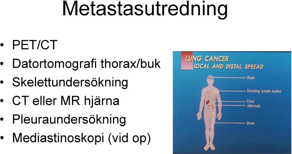 Skelettundersökning CT eller MR