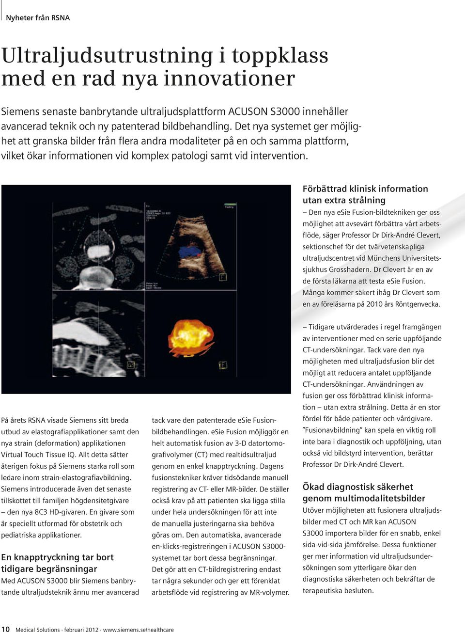 Förbättrad klinisk information utan extra strålning Den nya esie Fusion-bildtekniken ger oss möjlighet att avsevärt förbättra vårt arbetsflöde, säger Professor Dr Dirk-André Clevert, sektionschef för