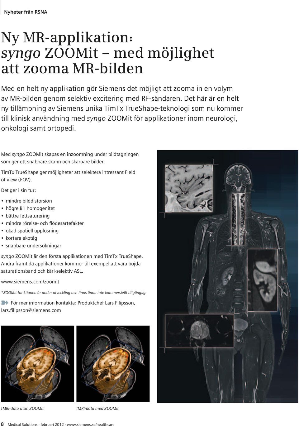 Det här är en helt ny tillämpning av Siemens unika TimTx TrueShape-teknologi som nu kommer till klinisk användning med syngo ZOOMit för applikationer inom neurologi, onkologi samt ortopedi.