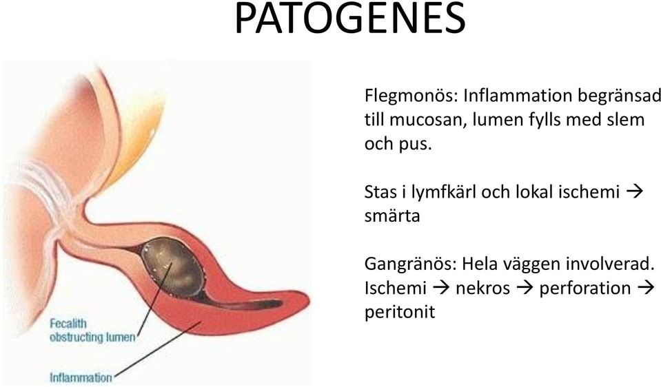 Stas i lymfkärl och lokal ischemi smärta