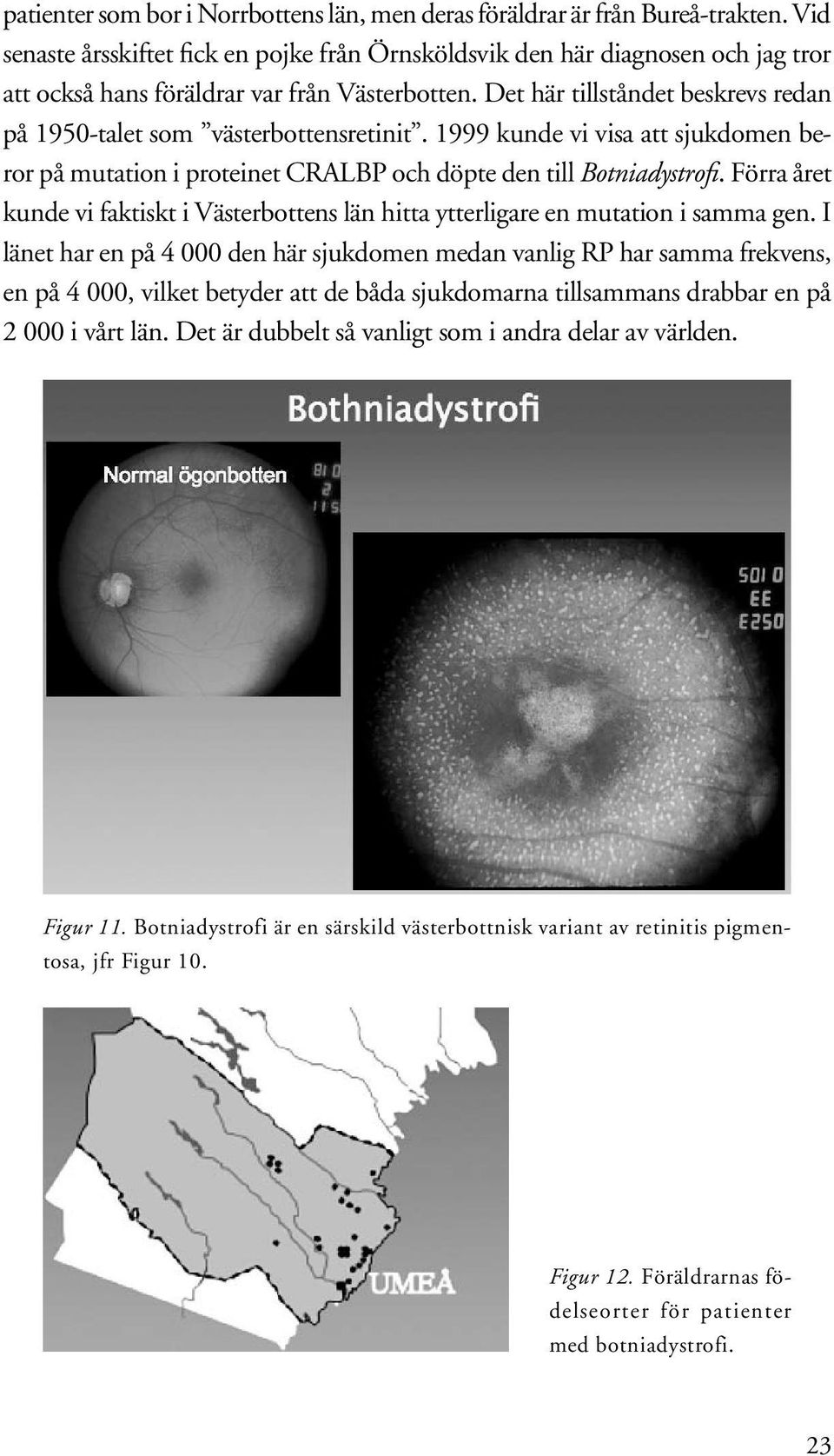 Det här tillståndet beskrevs redan på 1950-talet som västerbottensretinit. 1999 kunde vi visa att sjukdomen beror på mutation i proteinet CRALBP och döpte den till Botniadystrofi.