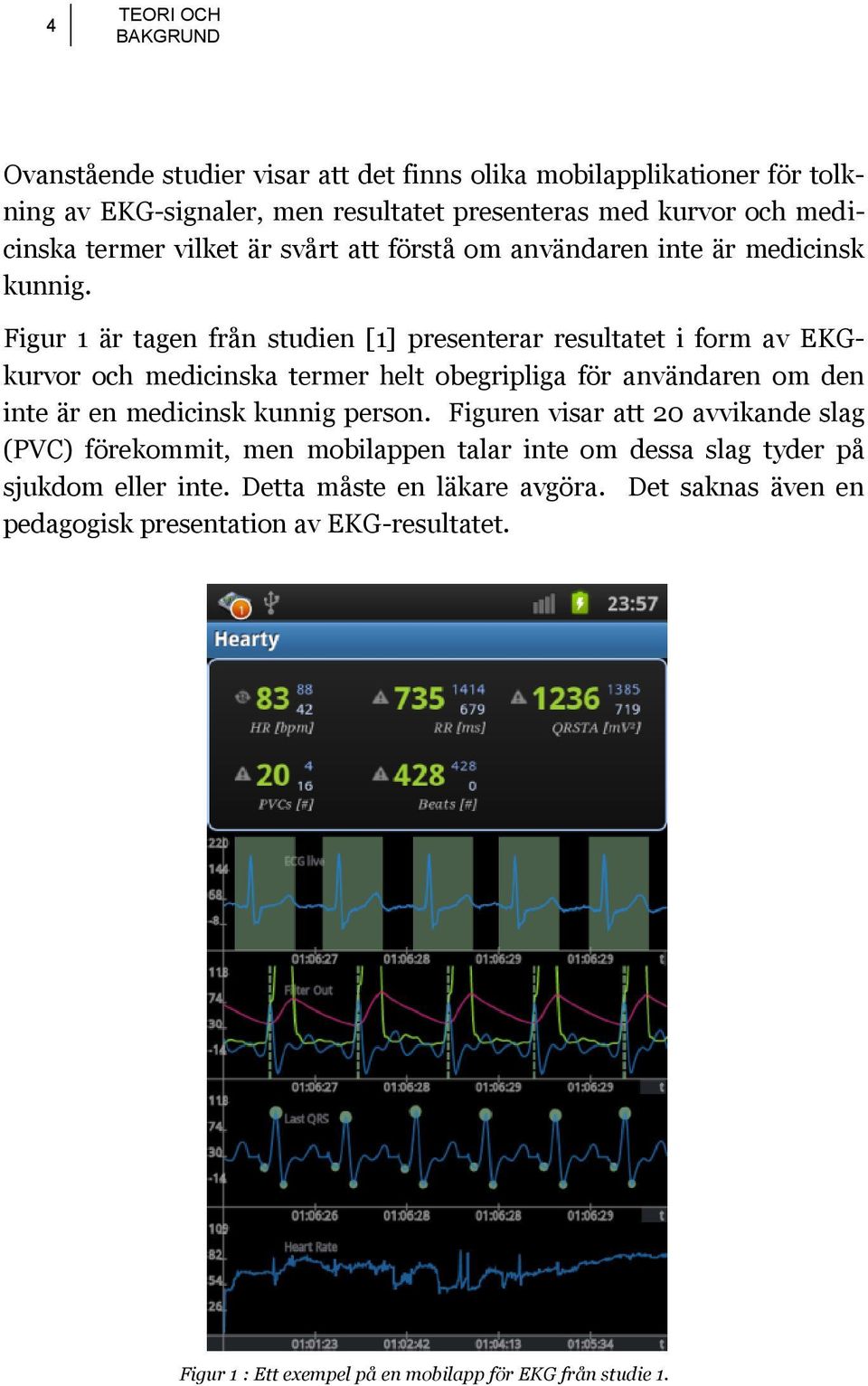 Figur 1 är tagen från studien [1] presenterar resultatet i form av EKGkurvor och medicinska termer helt obegripliga för användaren om den inte är en medicinsk kunnig person.