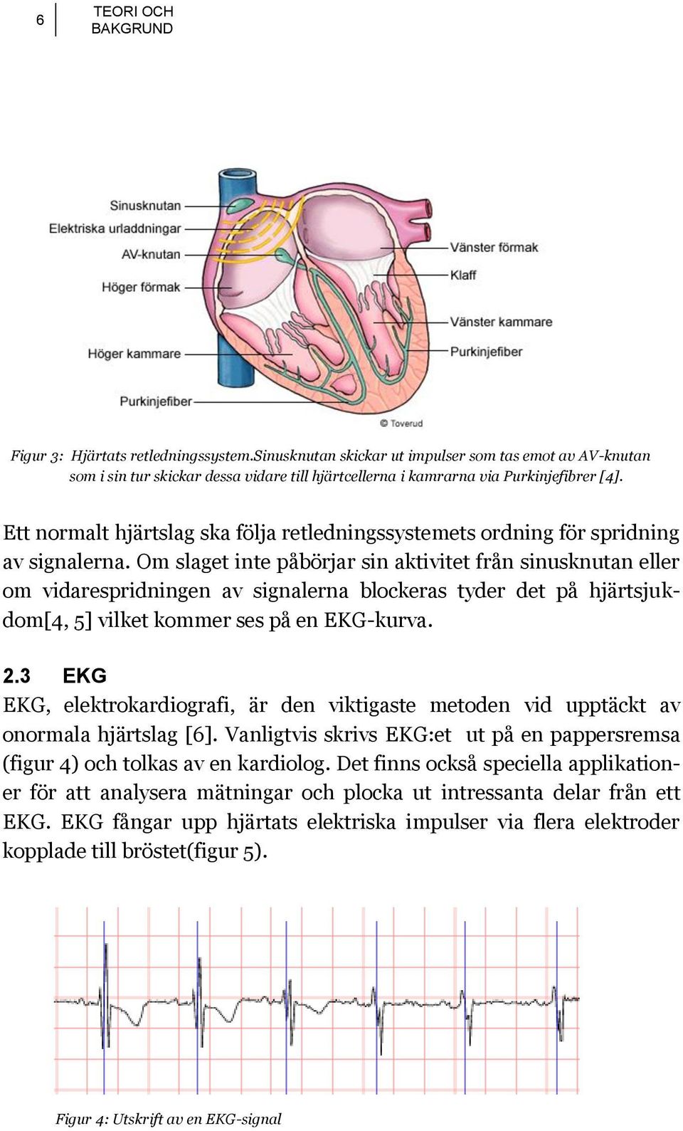 Ett normalt hjärtslag ska följa retledningssystemets ordning för spridning av signalerna.