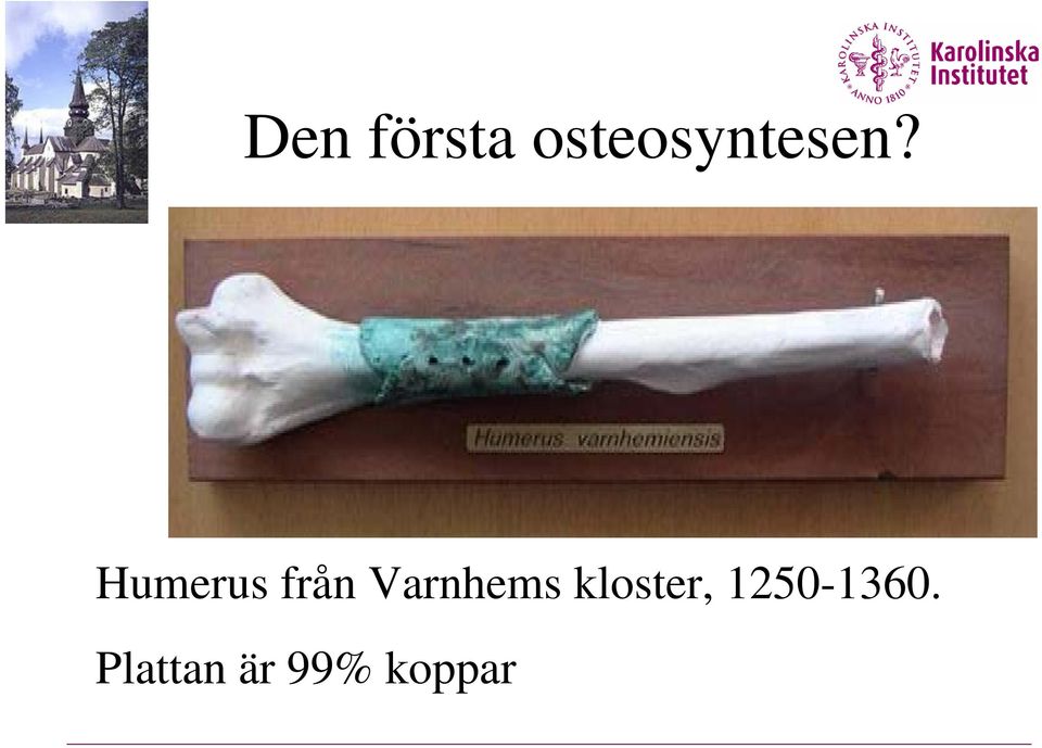 Humerus från Varnhems