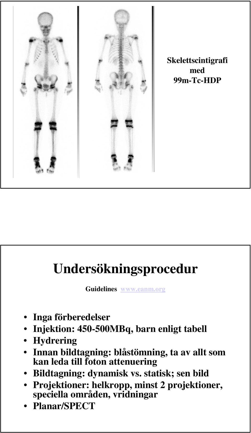 bildtagning: blåstömning, ta av allt som kan leda till foton attenuering Bildtagning: