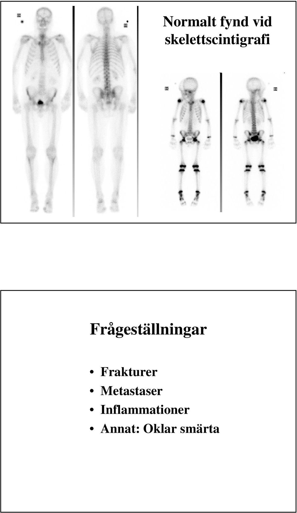 Frågeställningar Frakturer