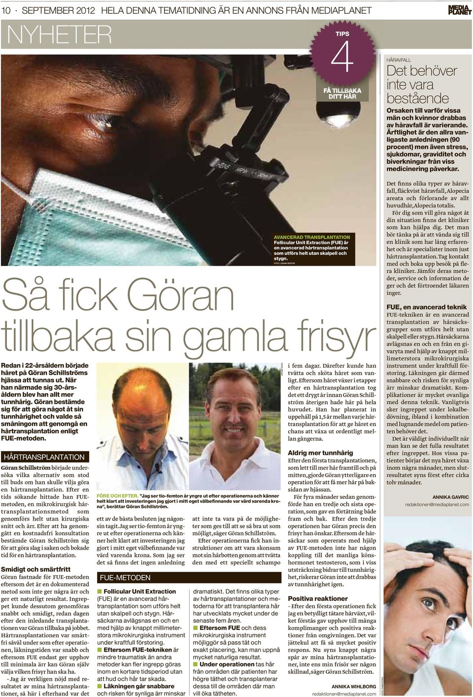 HÅRTRANSPLANTATION Göran Schillström började undersöka vilka alternativ som stod till buds om han skulle vilja göra en hårtransplantation.