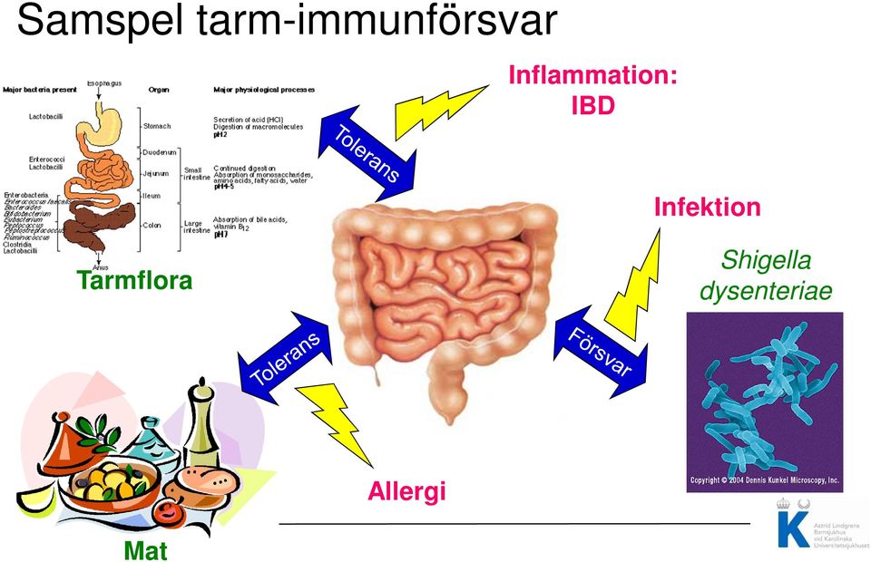 Inflammation: IBD