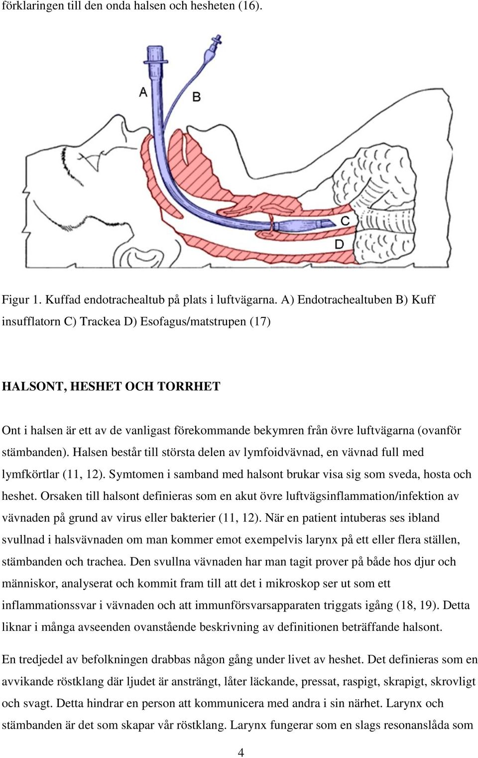 stämbanden). Halsen består till största delen av lymfoidvävnad, en vävnad full med lymfkörtlar (11, 12). Symtomen i samband med halsont brukar visa sig som sveda, hosta och heshet.