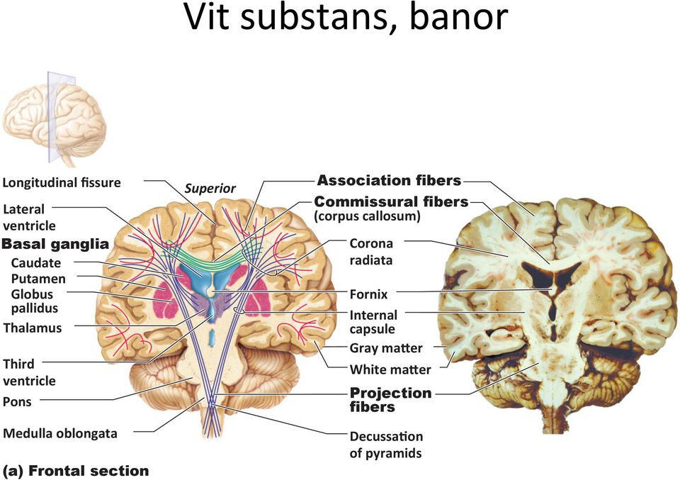 section Superior Association fibers Commissural fibers (corpus callosum) Corona