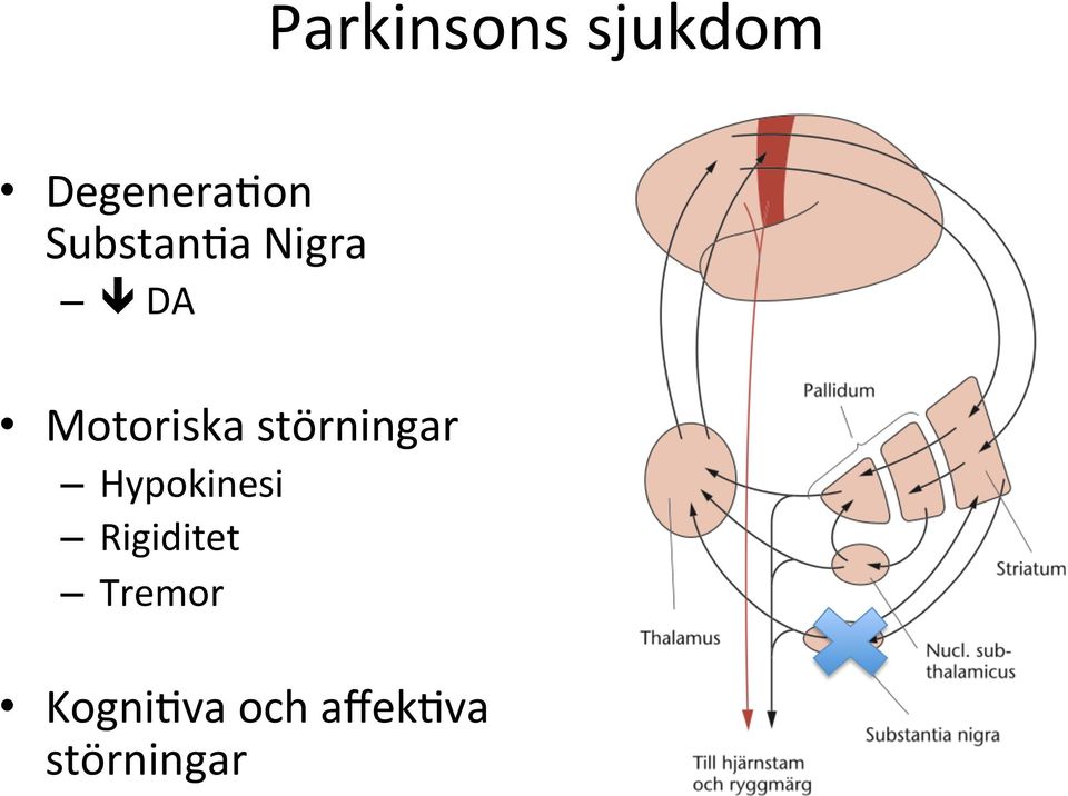 störningar Hypokinesi Rigiditet