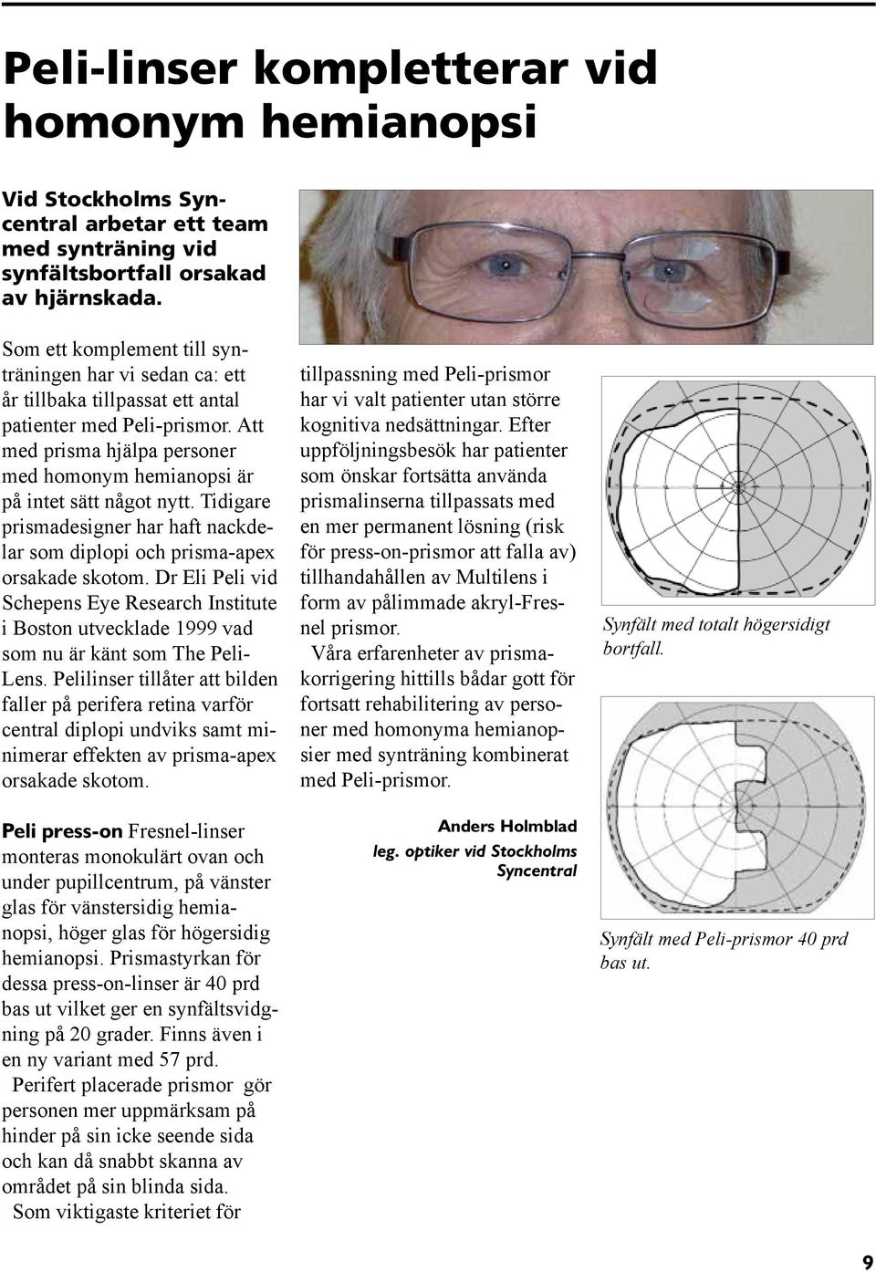 Att med prisma hjälpa personer med homonym hemianopsi är på intet sätt något nytt. Tidigare prismadesigner har haft nackdelar som diplopi och prisma-apex orsakade skotom.