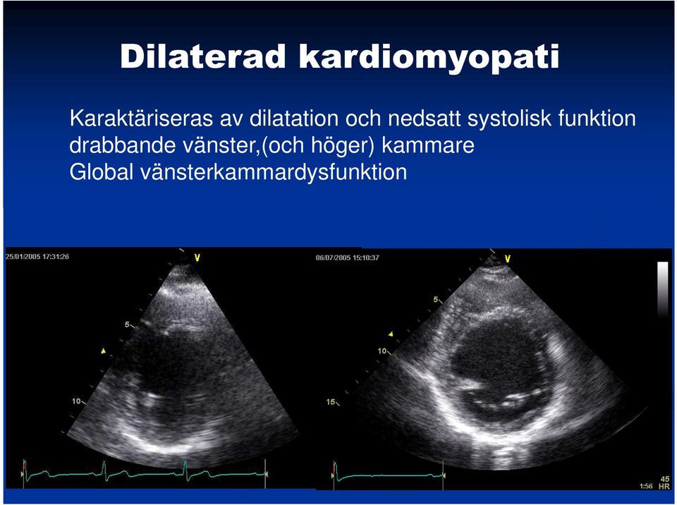 funktion drabbande vänster,(och höger)