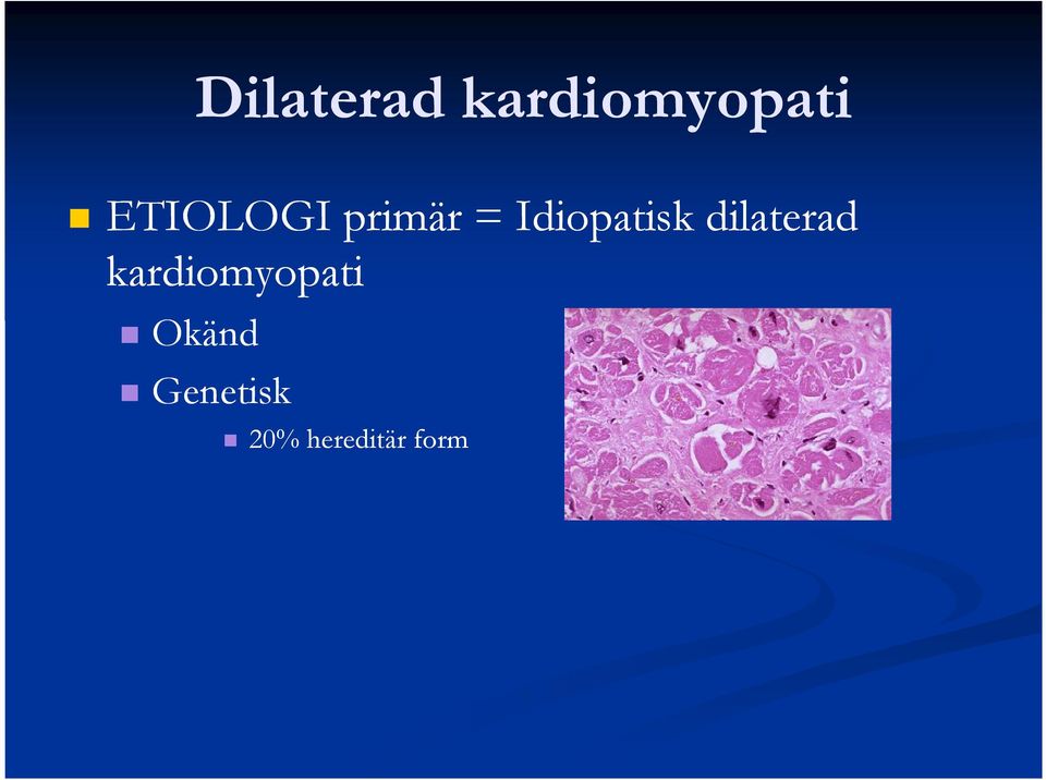 Idiopatisk dilaterad