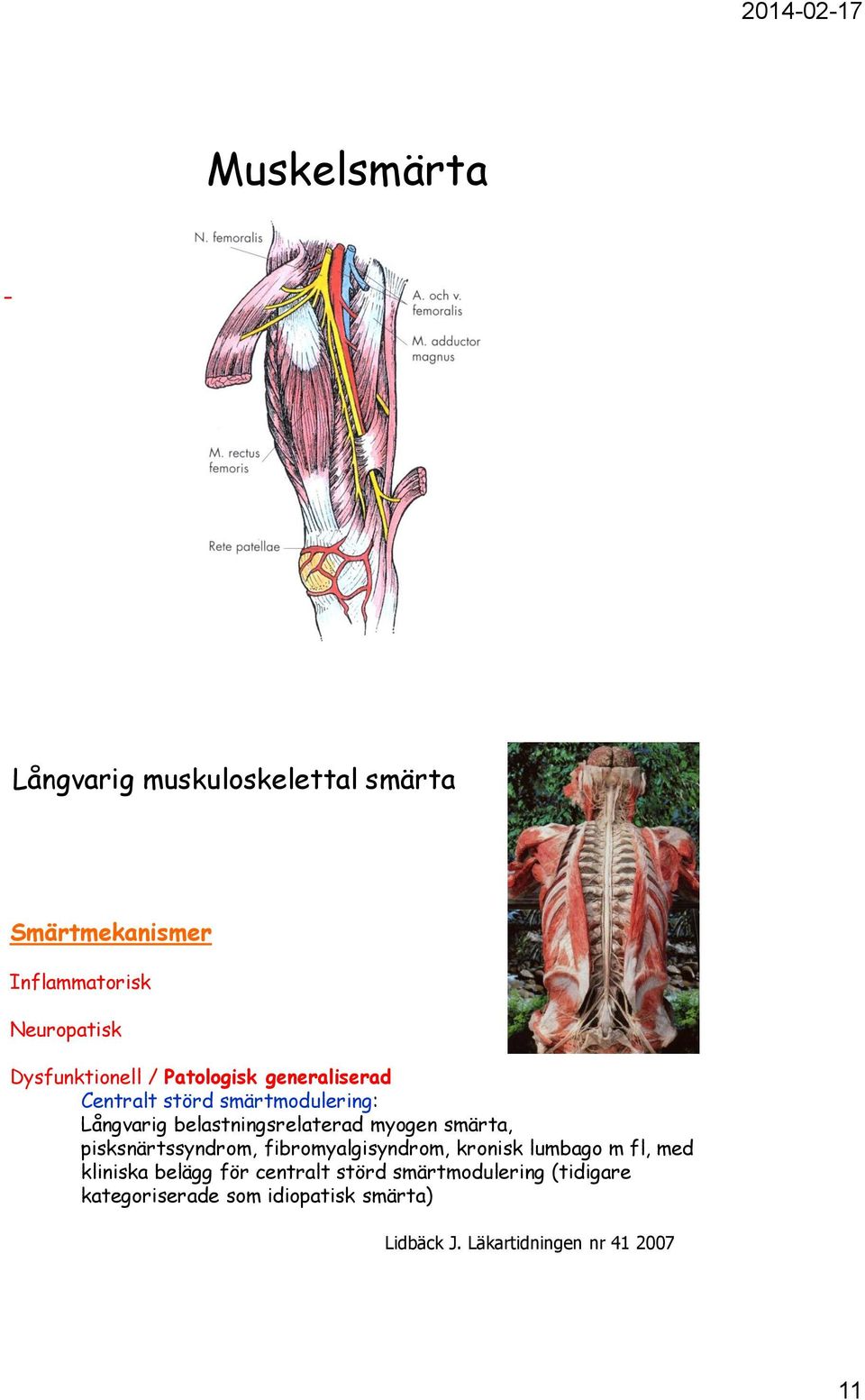 belastningsrelaterad myogen smärta, pisksnärtssyndrom, fibromyalgisyndrom, kronisk lumbago m fl, med