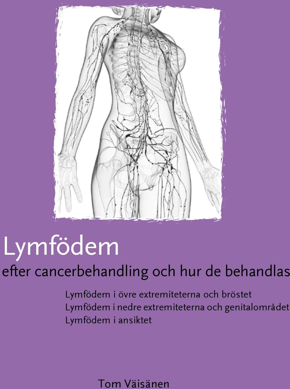 bröstet Lymfödem i nedre extremiteterna och