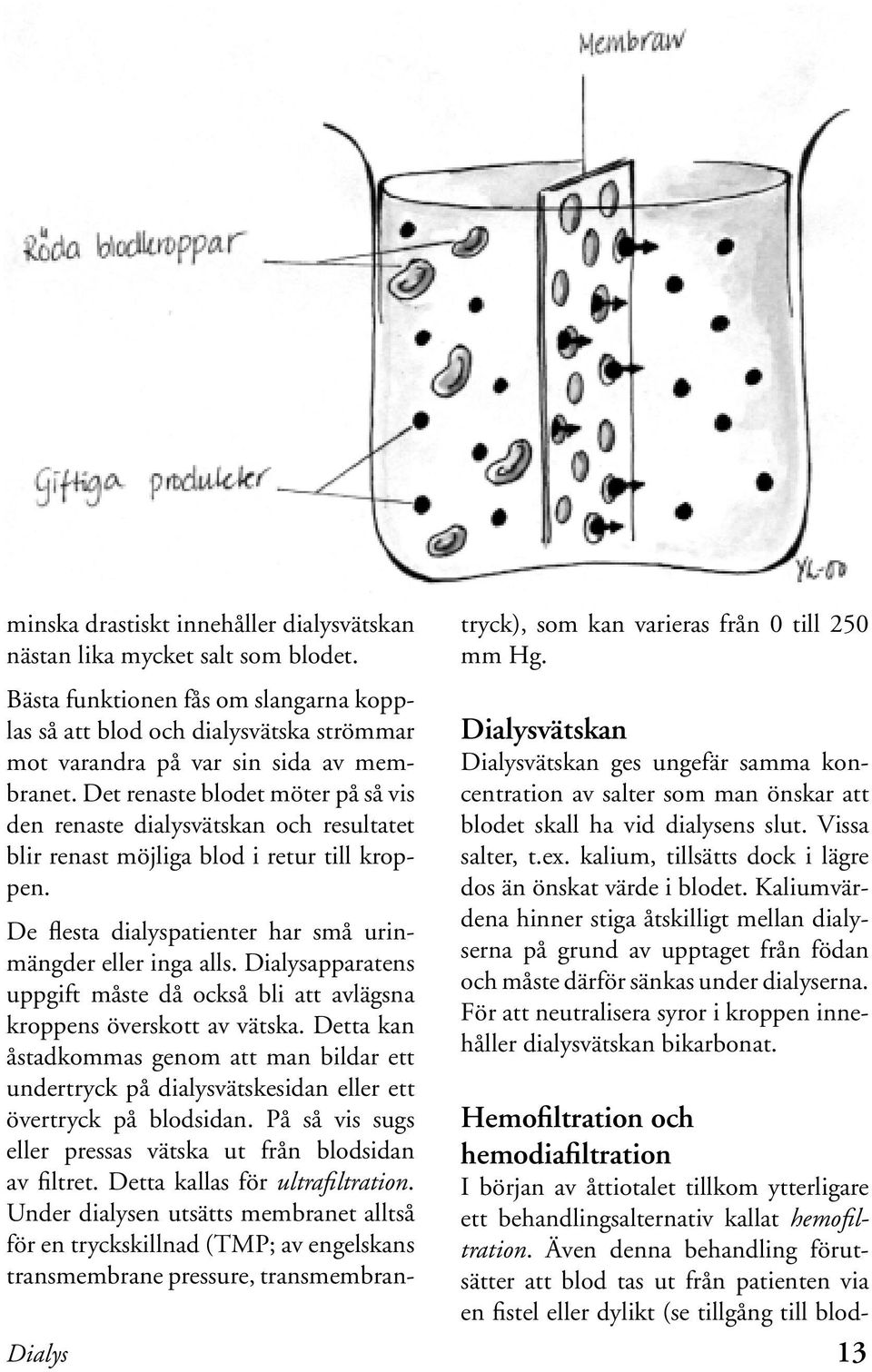 Dialysapparatens uppgift måste då också bli att avlägsna kroppens överskott av vätska. Detta kan åstadkommas genom att man bildar ett undertryck på dialysvätskesidan eller ett övertryck på blodsidan.