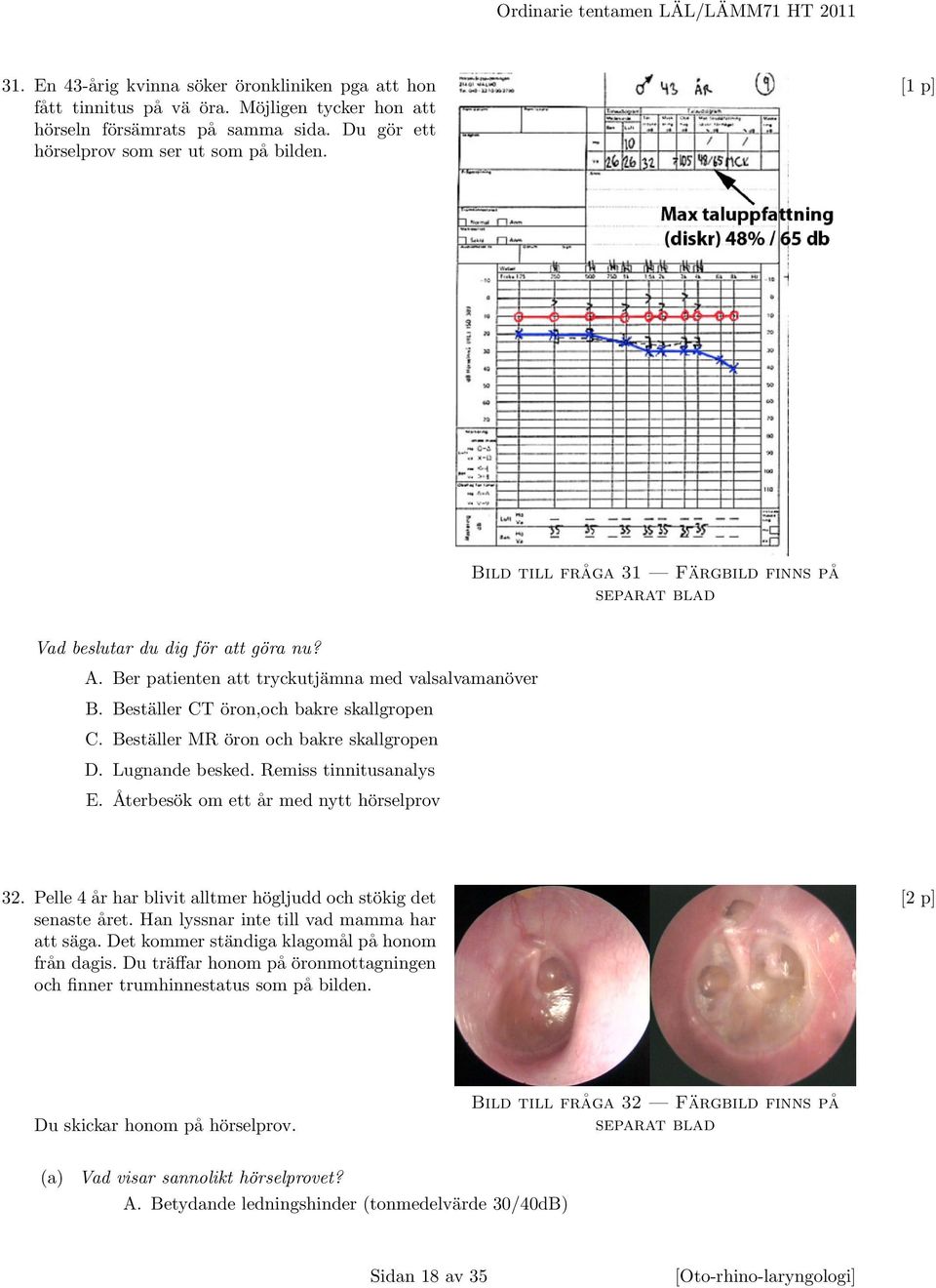 Beställer CT öron,och bakre skallgropen C. Beställer MR öron och bakre skallgropen D. Lugnande besked. Remiss tinnitusanalys E. Återbesök om ett år med nytt hörselprov 32.