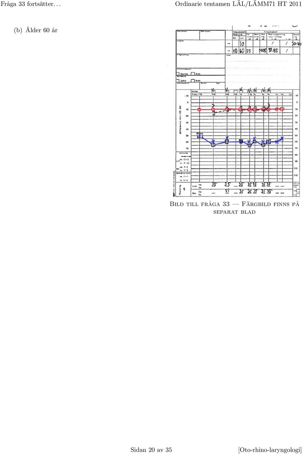 (b) Ålder 60 år Bild till fråga 33