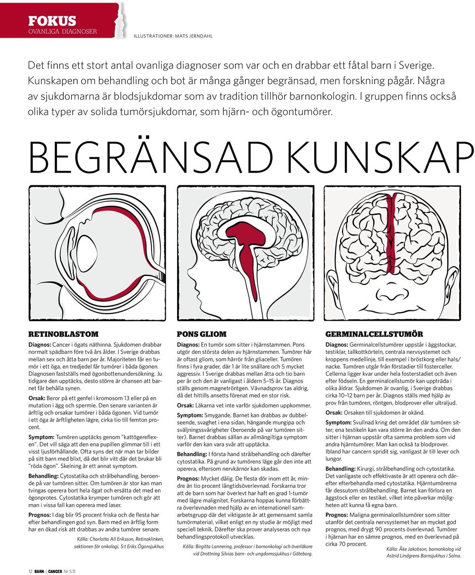 I gruppen finns också olika typer av solida tumörsjukdomar, som hjärn- och ögontumörer. begränsad kunskap Retinoblastom pons gliom germinalcellstumör Diagnos: Cancer i ögats näthinna.