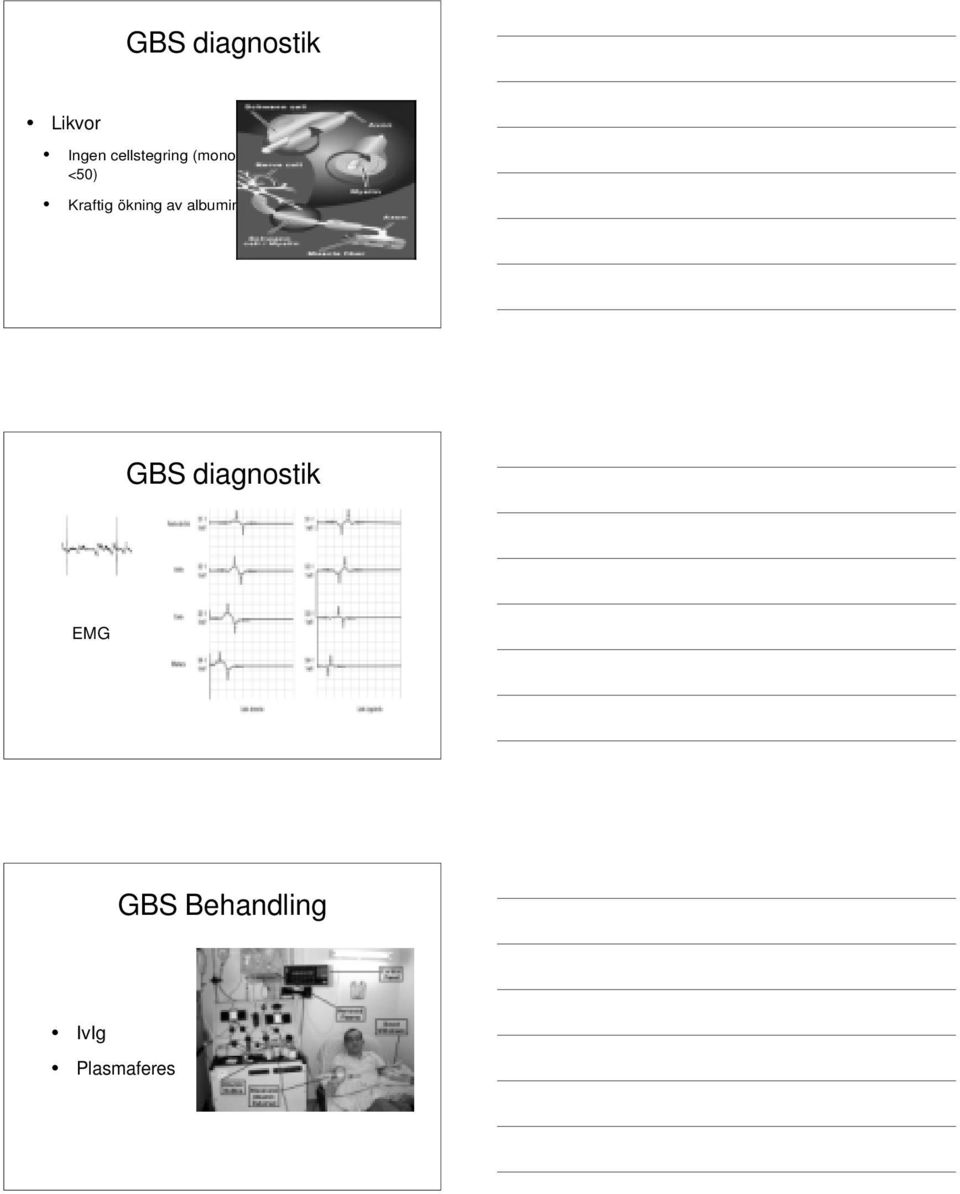 ökning av albumin GBS