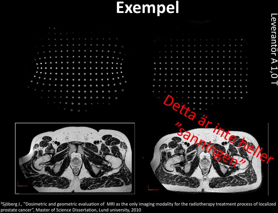 imaging modality for the radiotherapy treatment process of