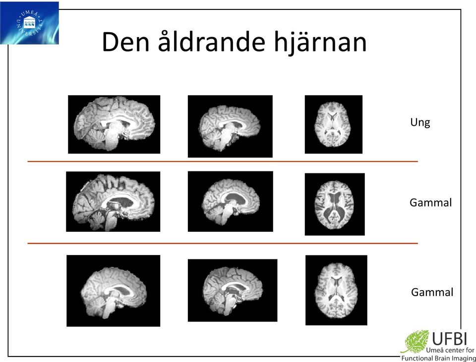 hjärnan