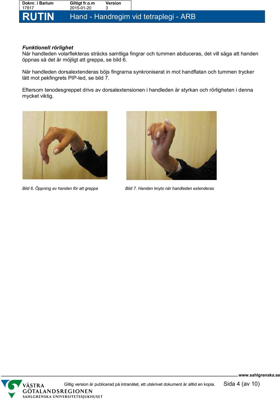 När handleden dorsalextenderas böjs fingrarna synkroniserat in mot handflatan och tummen trycker lätt mot pekfingrets PIP-led, se bild 7.