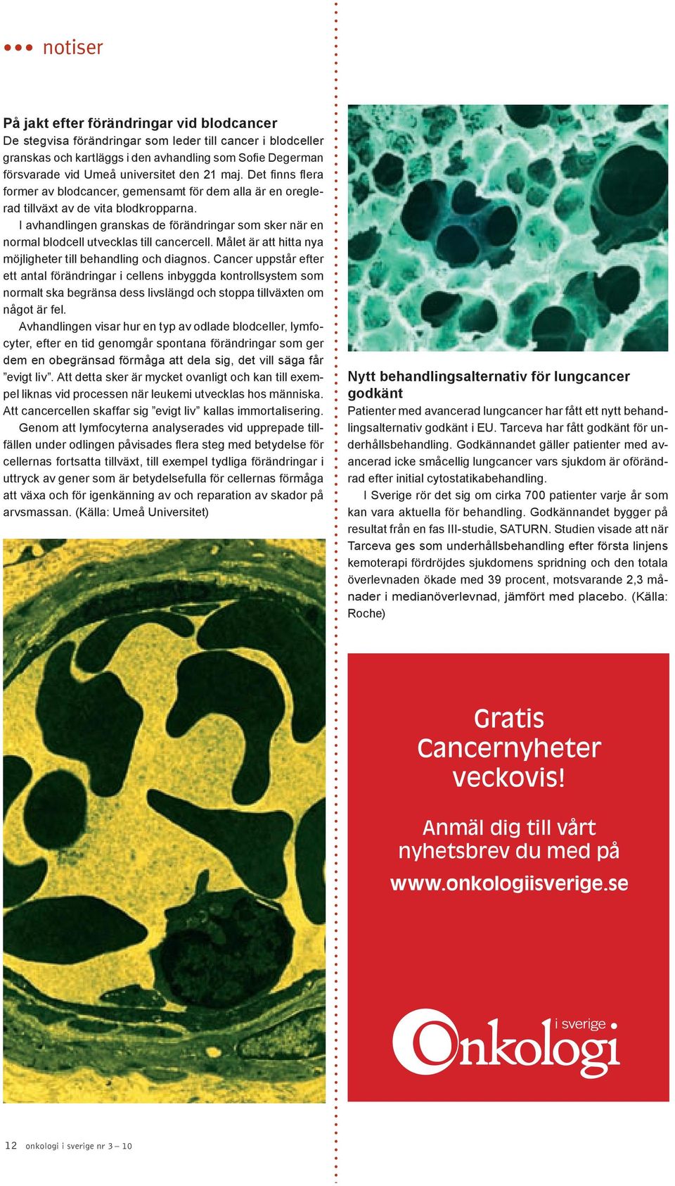 I avhandlingen granskas de förändringar som sker när en normal blodcell utvecklas till cancercell. Målet är att hitta nya möjligheter till behandling och diagnos.