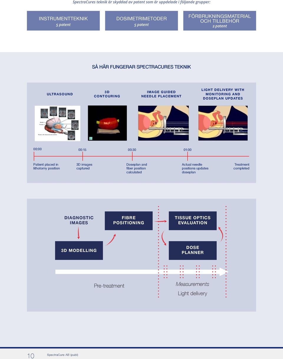 00:15 00:30 01:00 Patient placed in lithotomy position 3D images captured Doseplan and fiber position calculated Actual needle positions updates doseplan Treatment