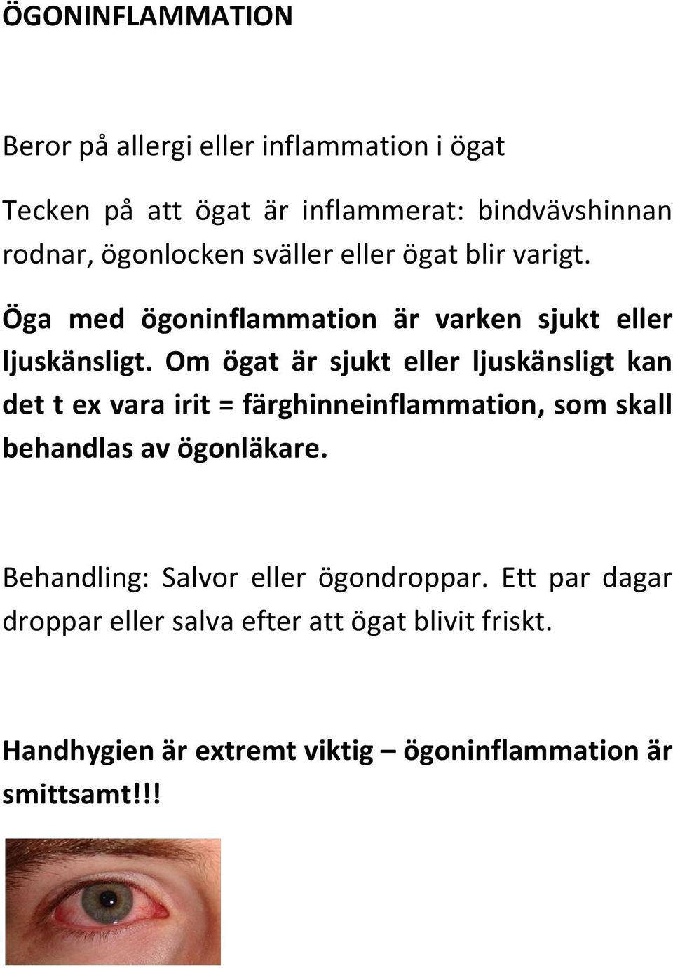 Om ögat är sjukt eller ljuskänsligt kan det t ex vara irit = färghinneinflammation, som skall behandlas av ögonläkare.