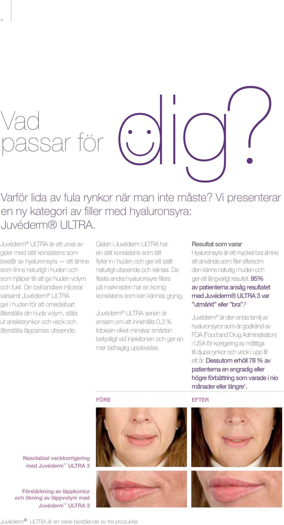 Din behandlare injicerar varsamt Juvéderm ULTRA gel i huden för att omedelbart återställa din huds volym, släta ut ansiktsrynkor och veck och återställa läpparnas utseende.