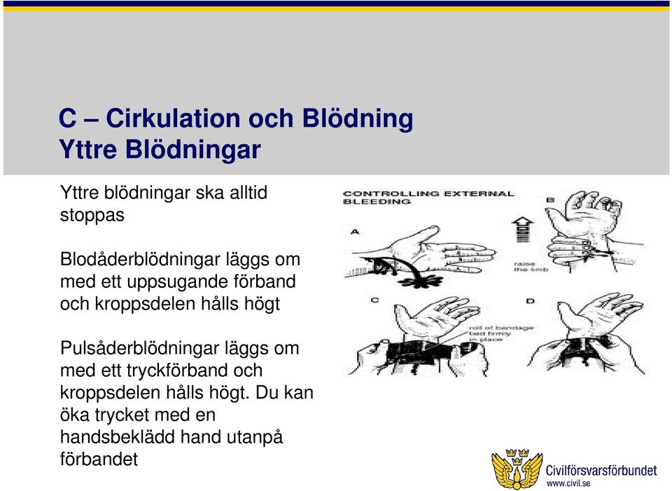 kroppsdelen hålls högt Pulsåderblödningar läggs om med ett tryckförband