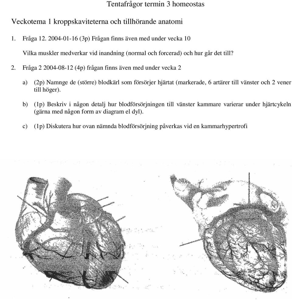 Fråga 2 2004-08-12 (4p) frågan finns även med under vecka 2 a) (2p) Namnge de (större) blodkärl som försörjer hjärtat (markerade, 6 artärer till vänster och 2