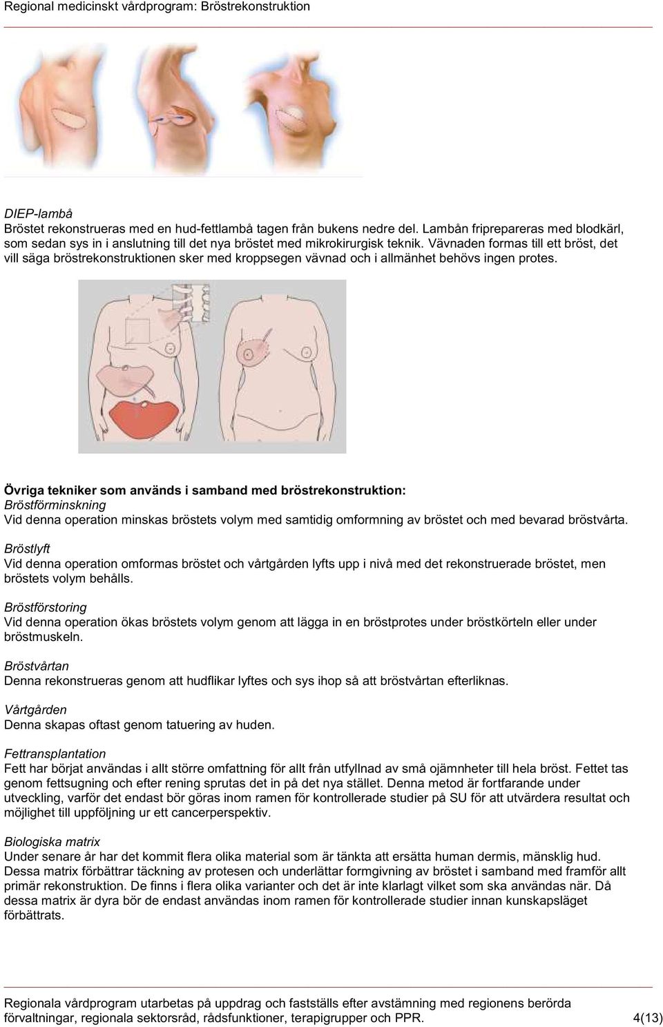 Övriga tekniker som används i samband med bröstrekonstruktion: Bröstförminskning Vid denna operation minskas bröstets volym med samtidig omformning av bröstet och med bevarad bröstvårta.