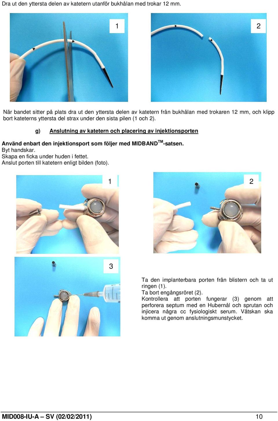 g) Anslutning av katetern och placering av injektionsporten Använd enbart den injektionsport som följer med MIDBAND TM -satsen. Byt handskar. Skapa en ficka under huden i fettet.
