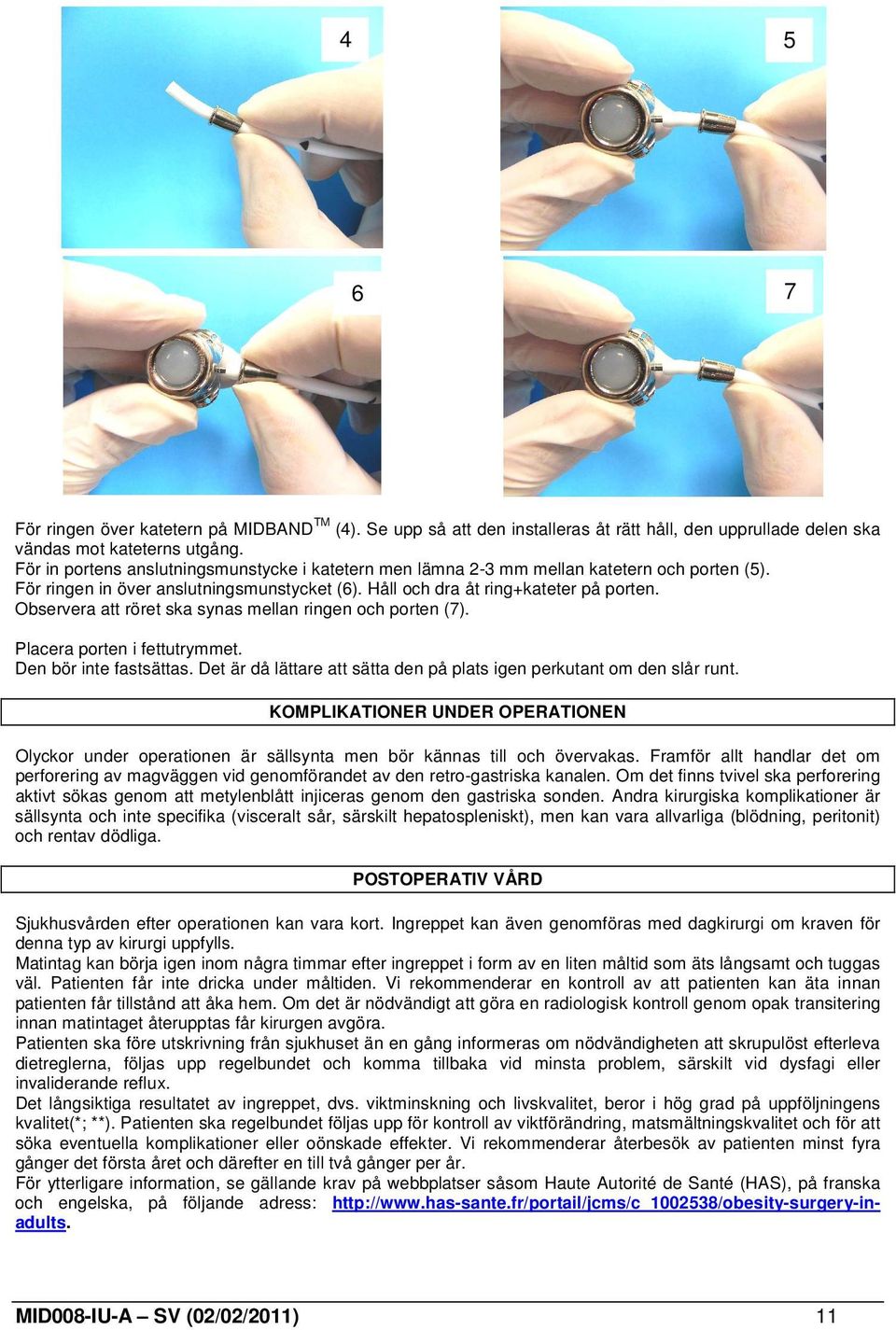 Observera att röret ska synas mellan ringen och porten (7). Placera porten i fettutrymmet. Den bör inte fastsättas. Det är då lättare att sätta den på plats igen perkutant om den slår runt.